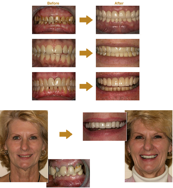 before and after